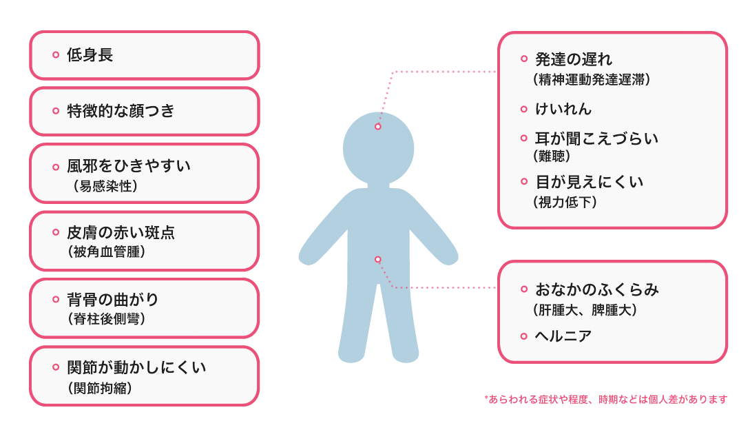 低身長、特徴的な顔つき、皮膚の赤い斑点、発達の遅れなどフコシドーシスの症状説明イラスト。