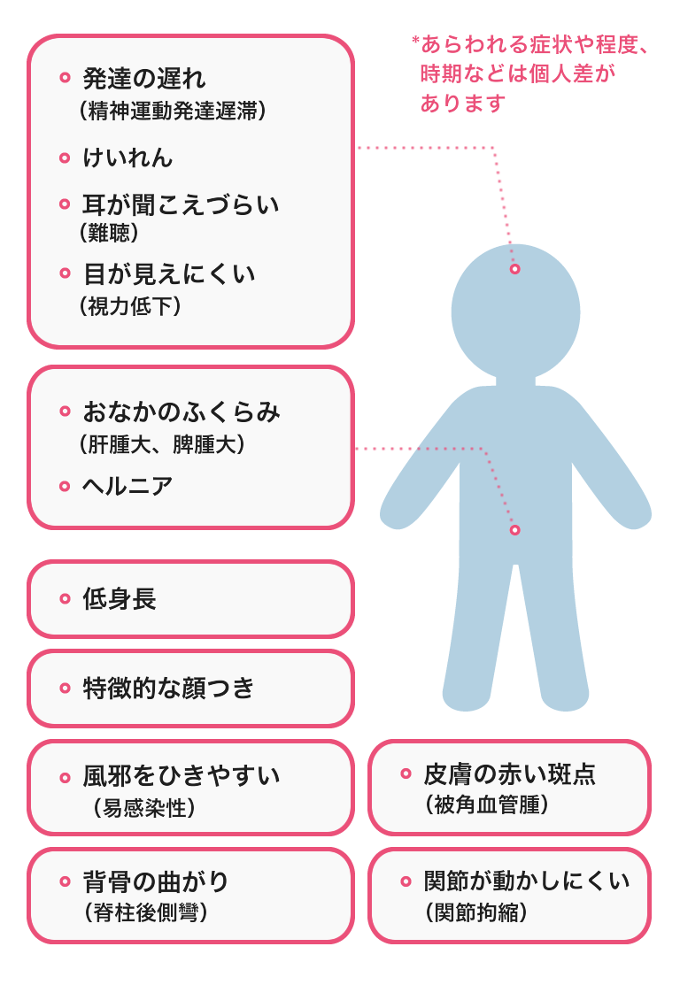 低身長、特徴的な顔つき、皮膚の赤い斑点、発達の遅れなどフコシドーシスの症状説明イラスト。