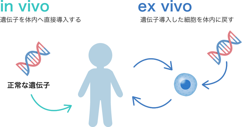 イラスト：遺伝子治療